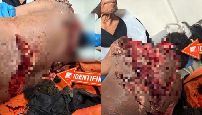 Luka Keji di Tubuh Delano Kambu, Ibu Korban Minta Polisi Segera Ungkap Pelaku Pembunuhan